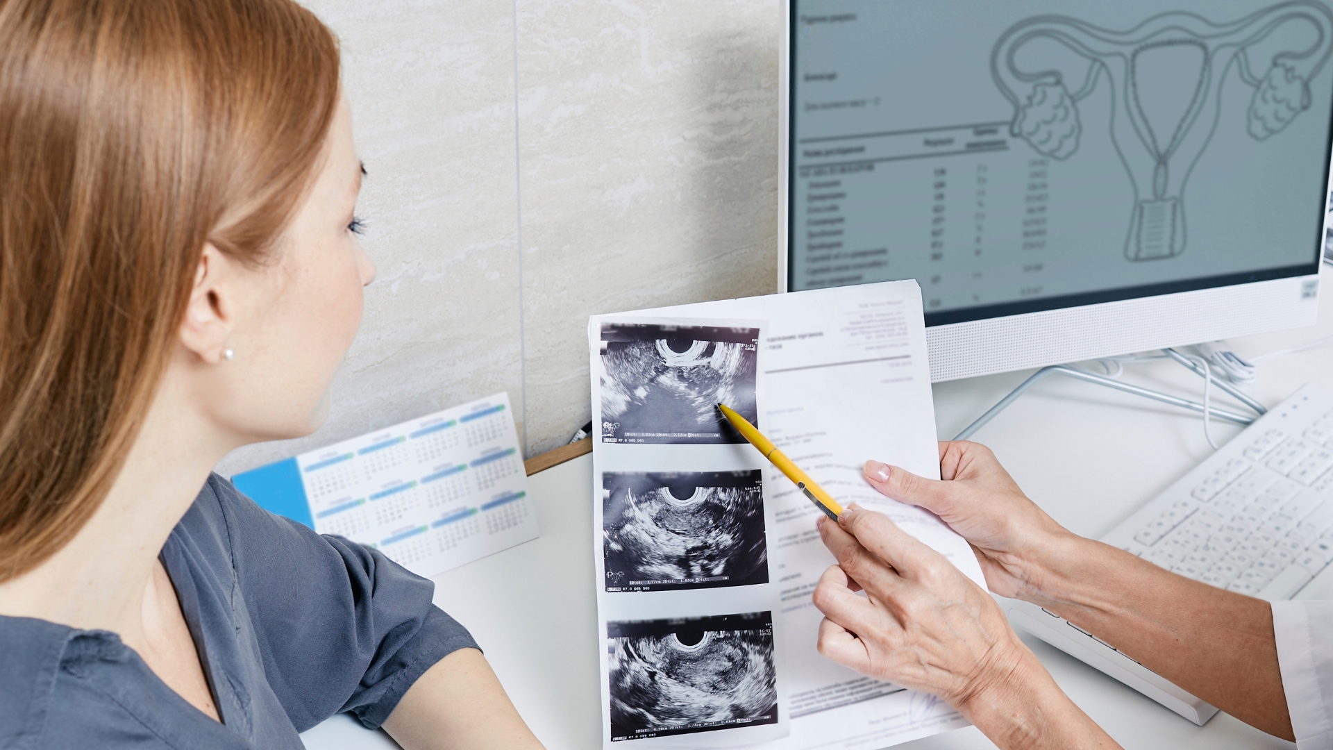 cysts Κύστεις Ωοθηκών