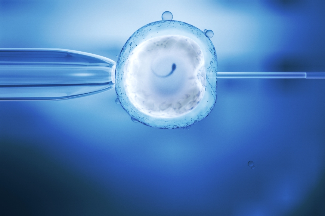 φυσικός_κύκλος_ivf Μικροέγχυση σπερματοζωαρίου σε ωάριο (ICSI) στο πλαίσιο εξωσωματικής γονιμοποίησης σε φυσικό κύκλο